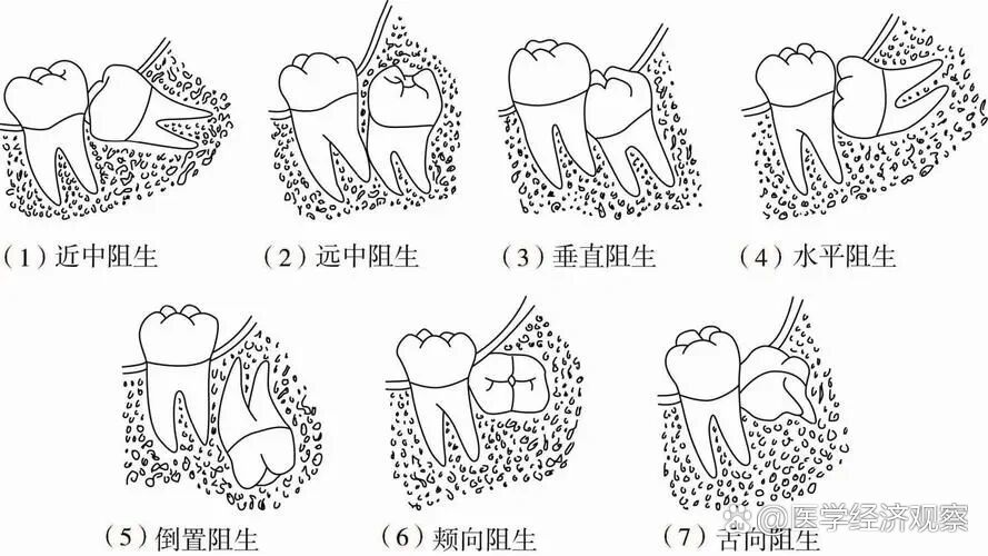 拔牙简笔画说明图片