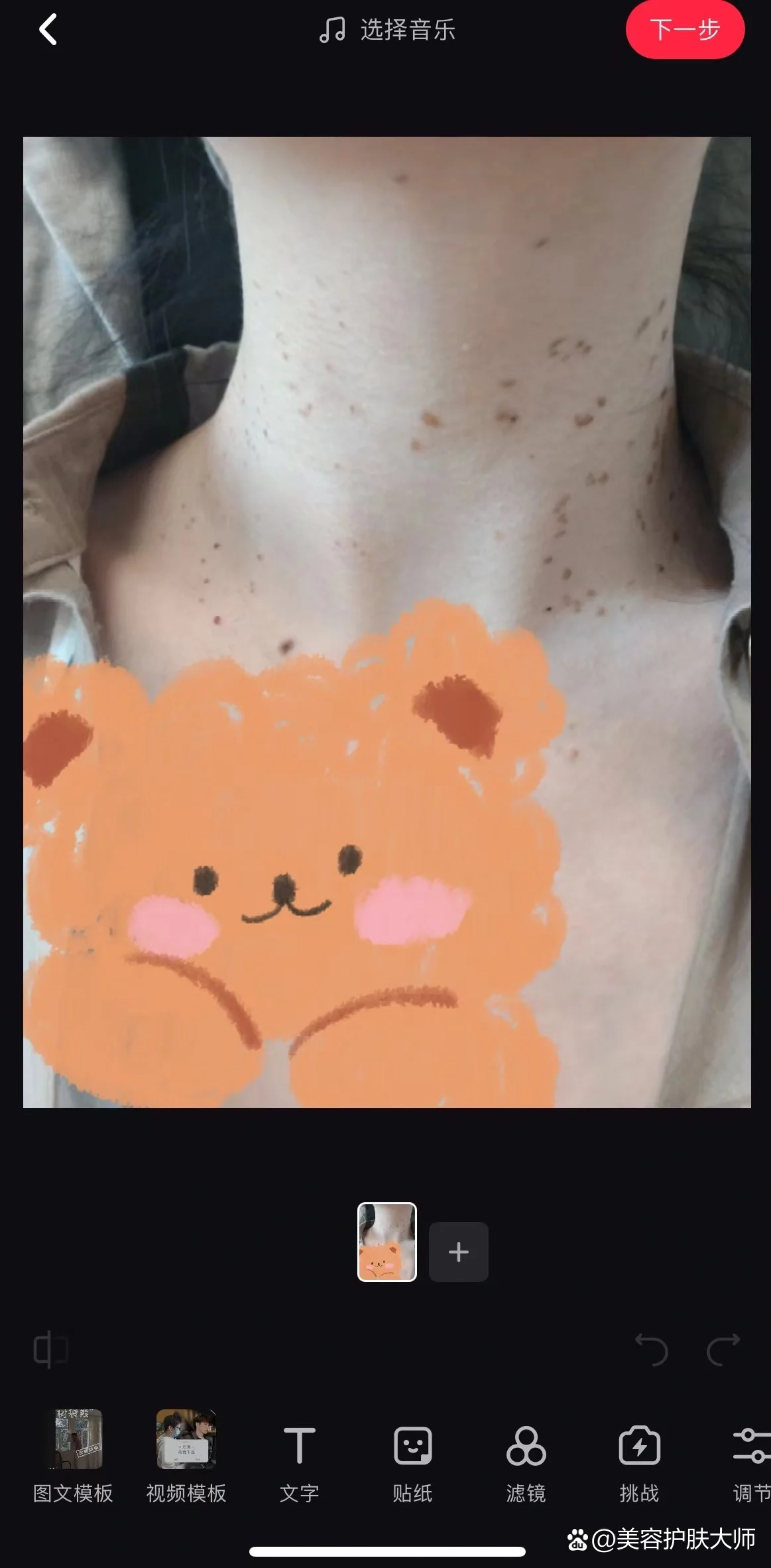 激光祛扁平疣之后留疤了