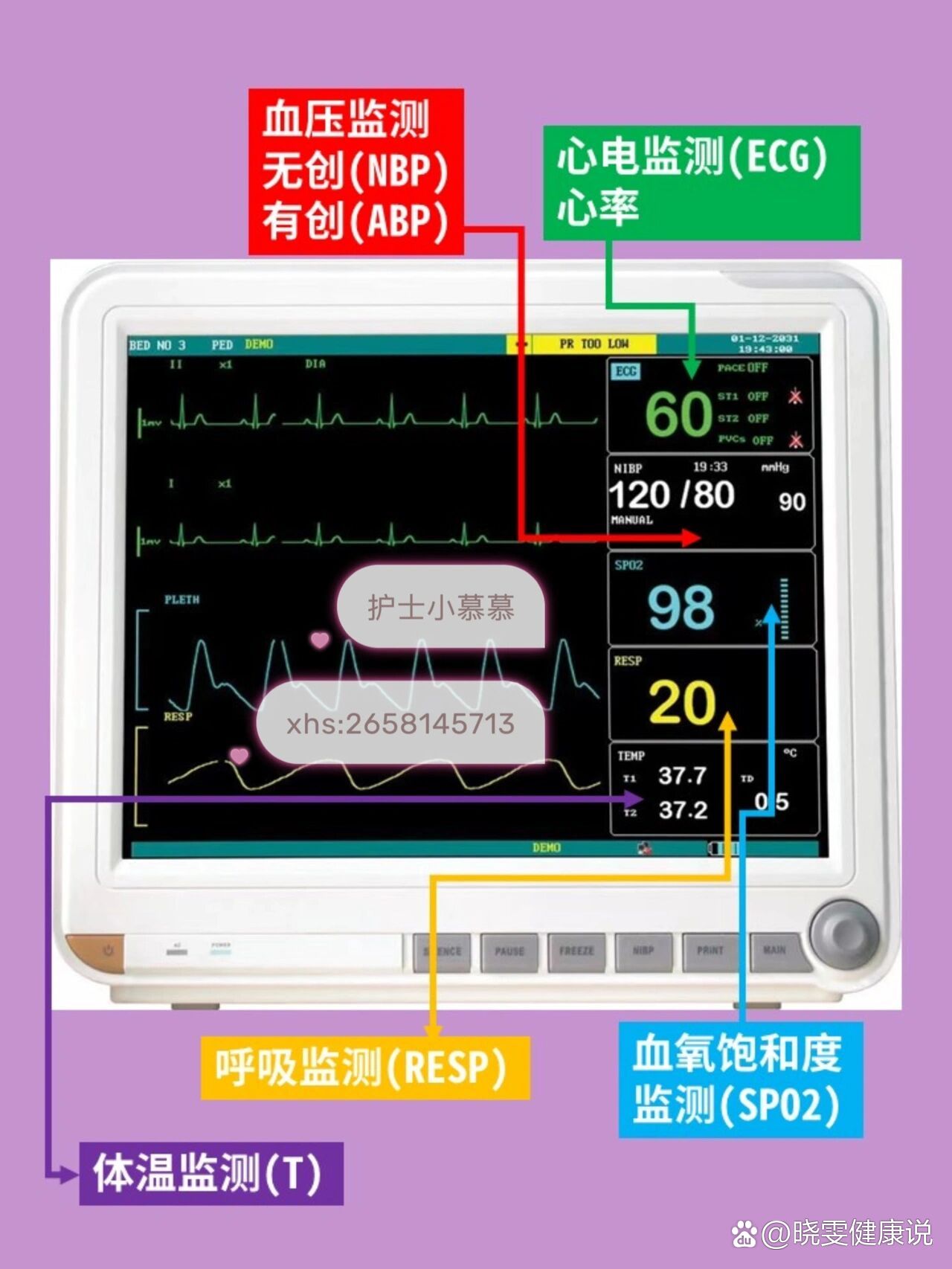 护士,教你看懂心电监护仪,超简单