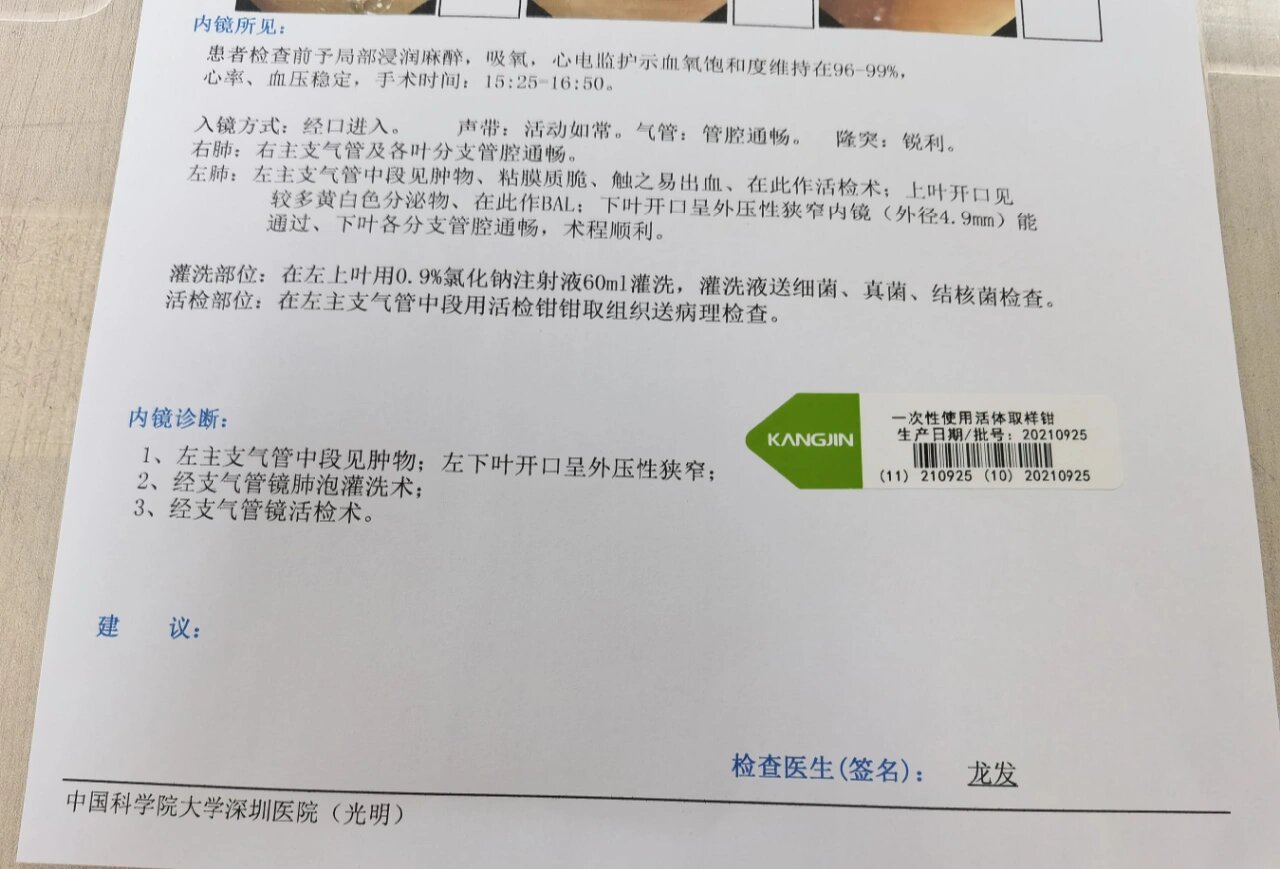 支气管镜检查(上)
