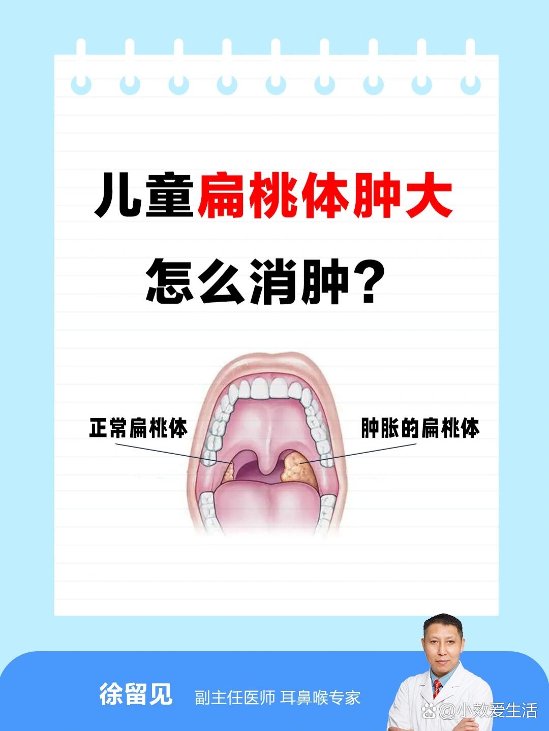 儿童扁桃体肿大怎么消肿?