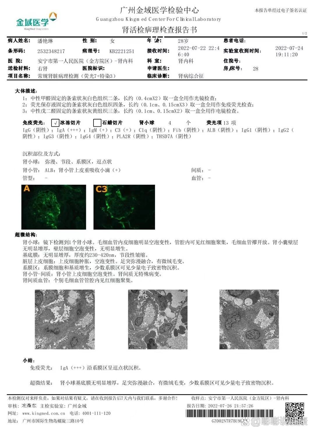 肾穿免疫荧光图片