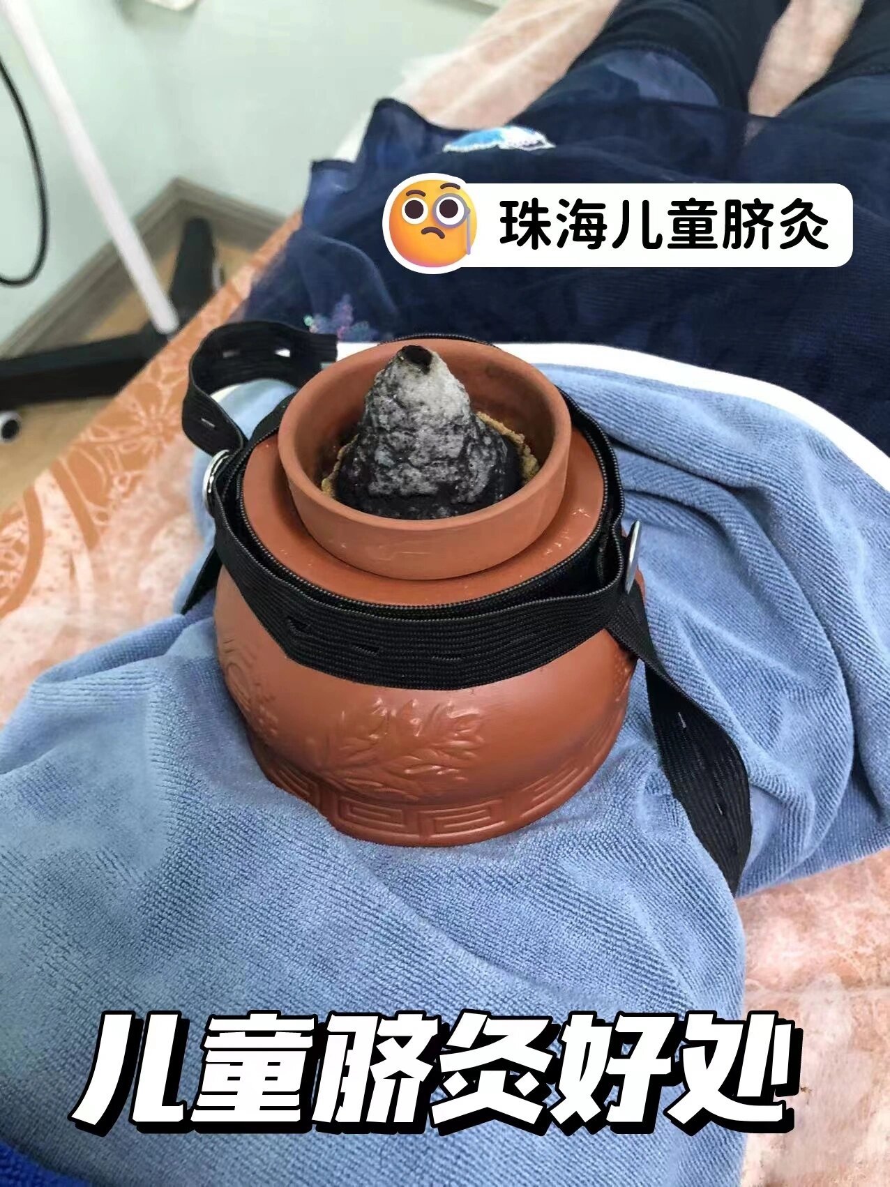 珠海脐灸