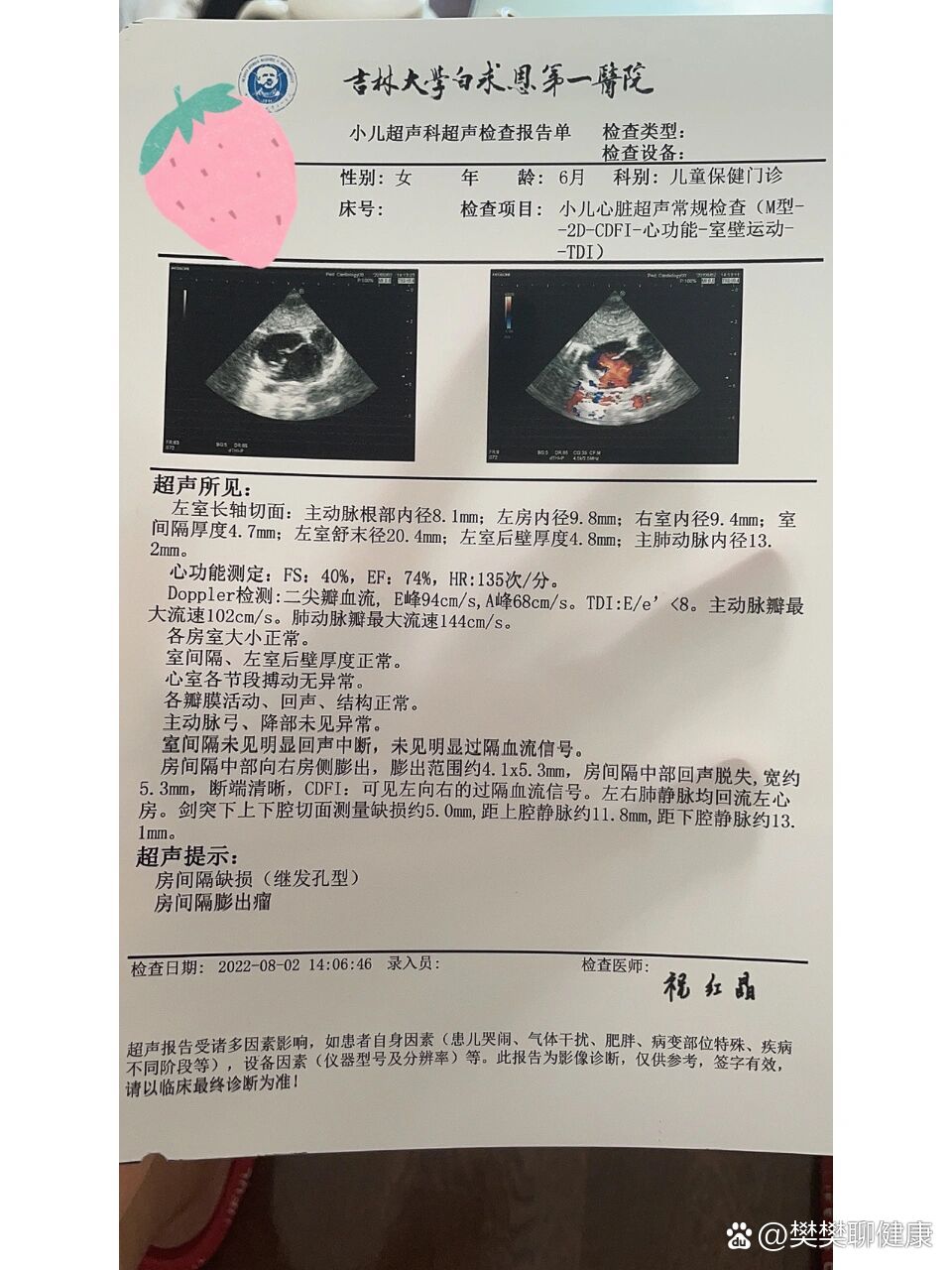 房间隔缺损