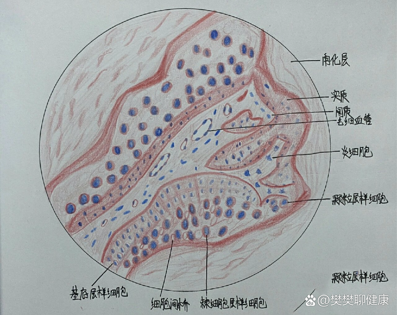 皮肤乳头状瘤画图图片