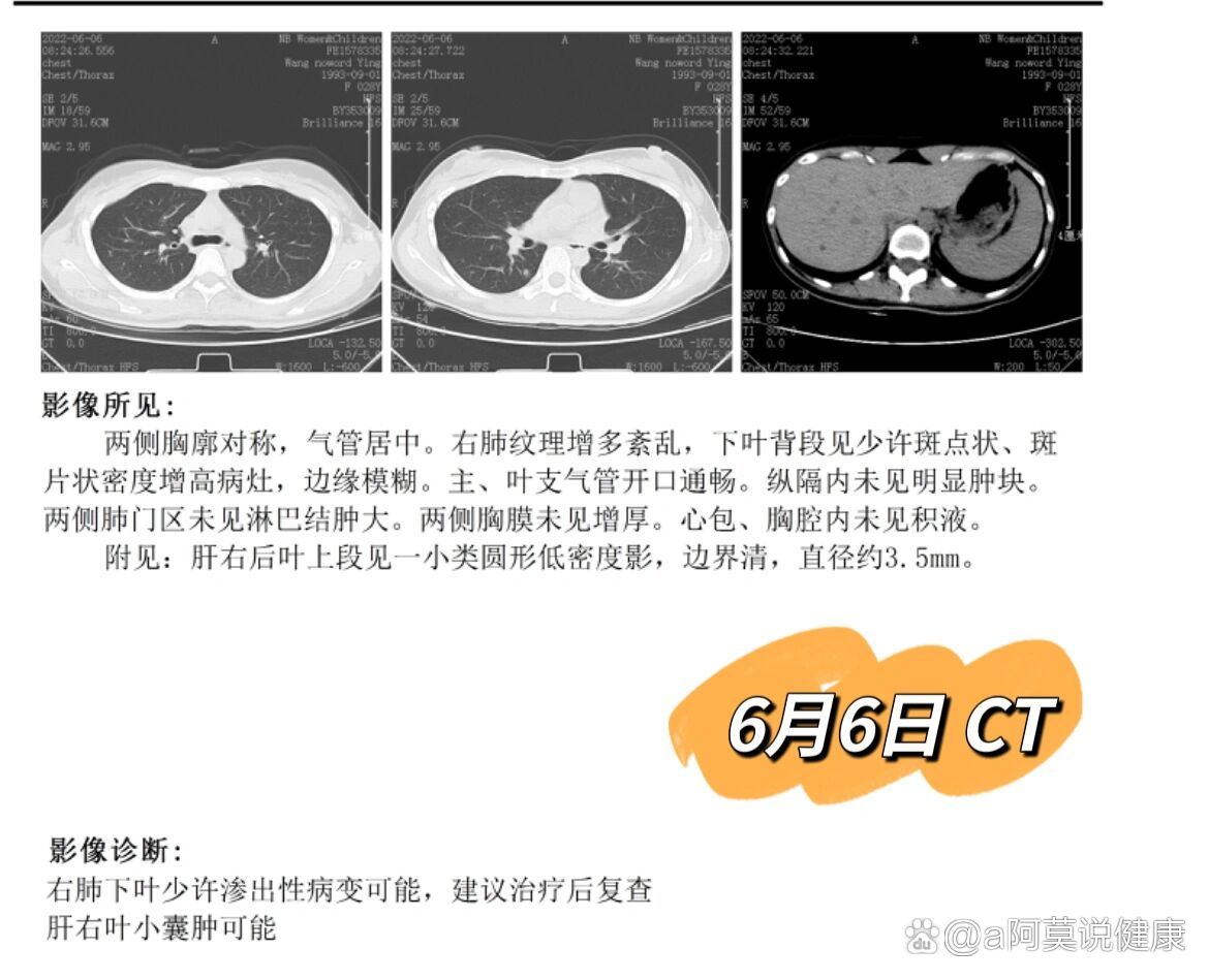 关于阜外医院代挂专家号加代问诊解决您的疑难问题的信息