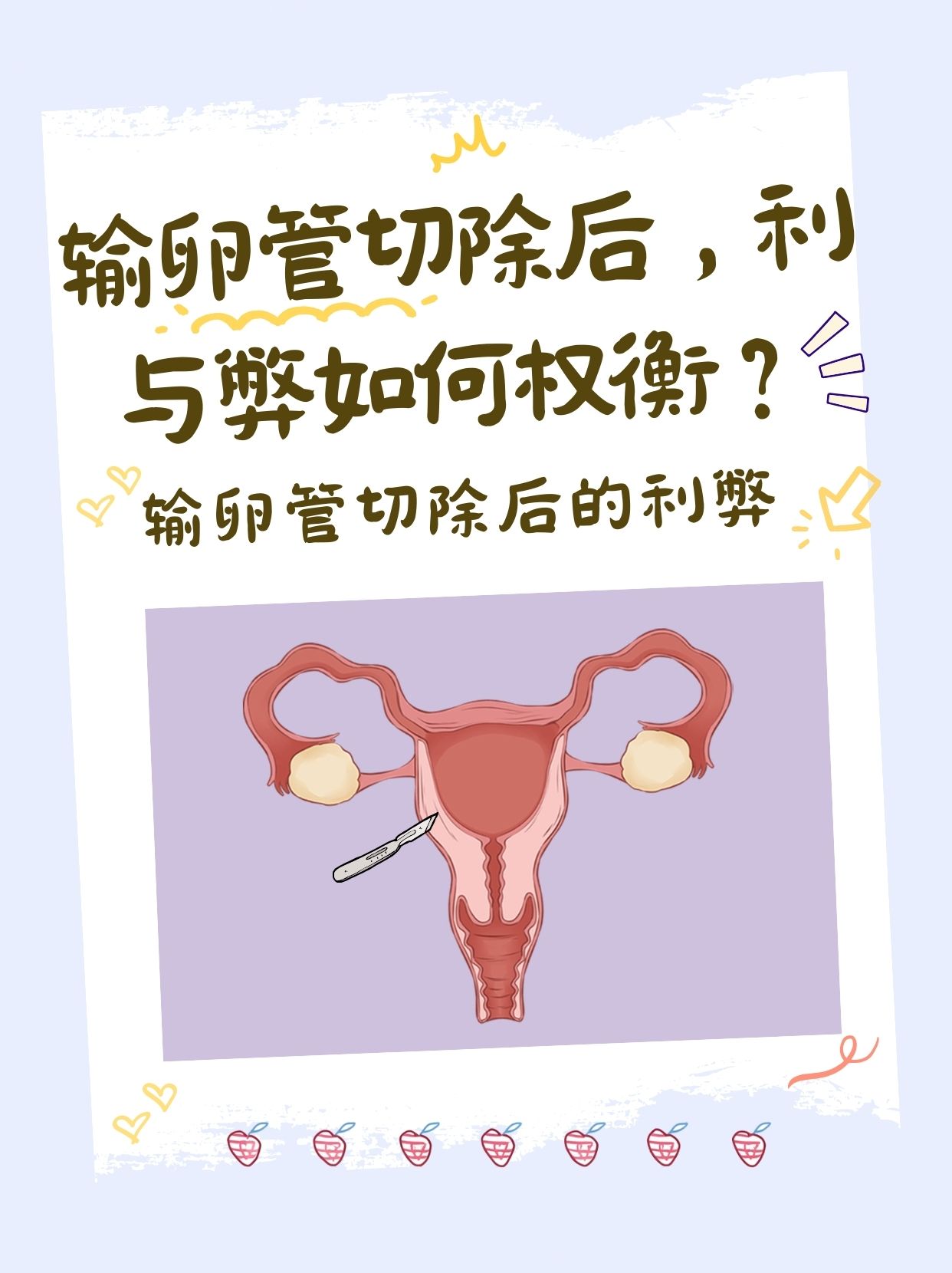 输卵管切除后,利与弊如何权衡?