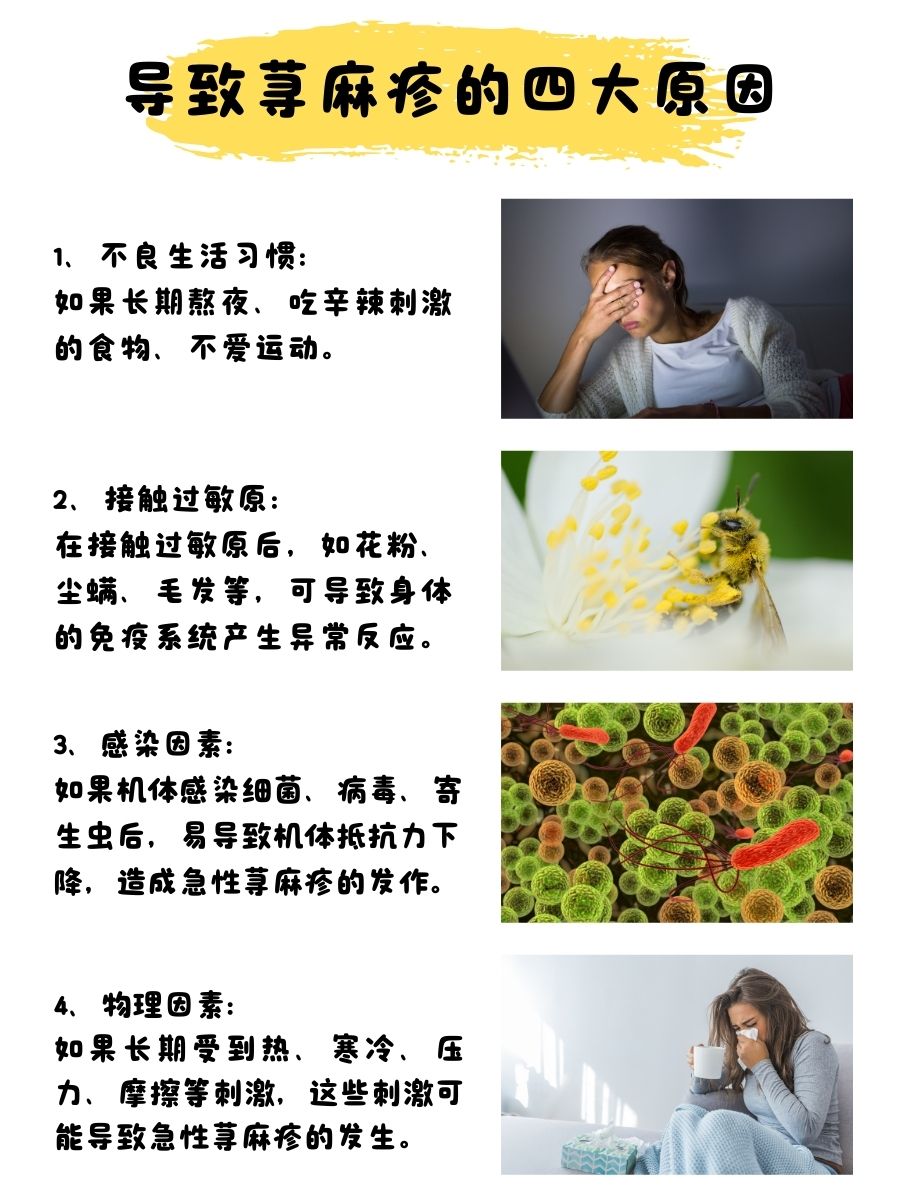 记得收藏:急性荨麻疹这样治才有效!