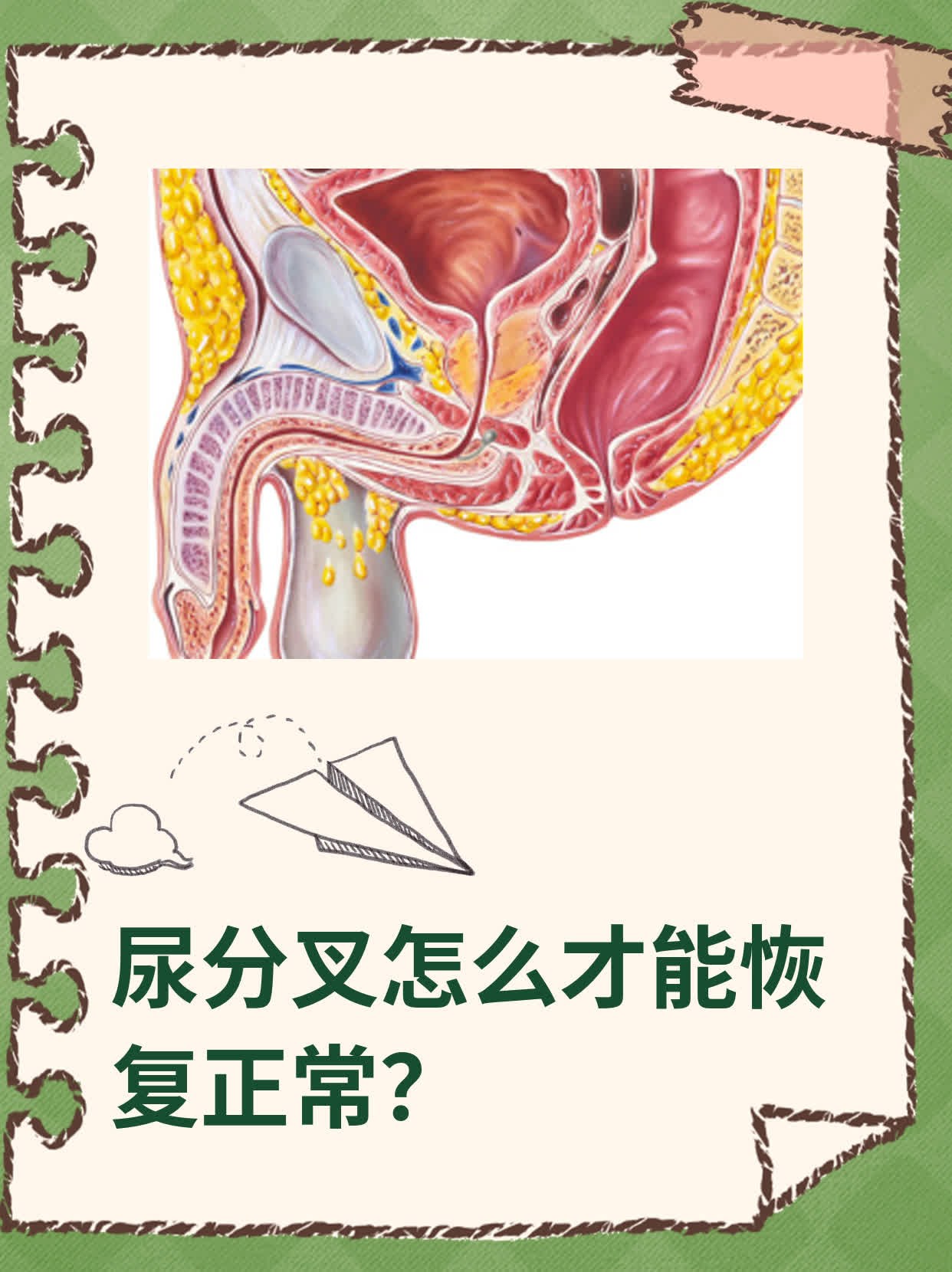 男人拉尿分叉图片