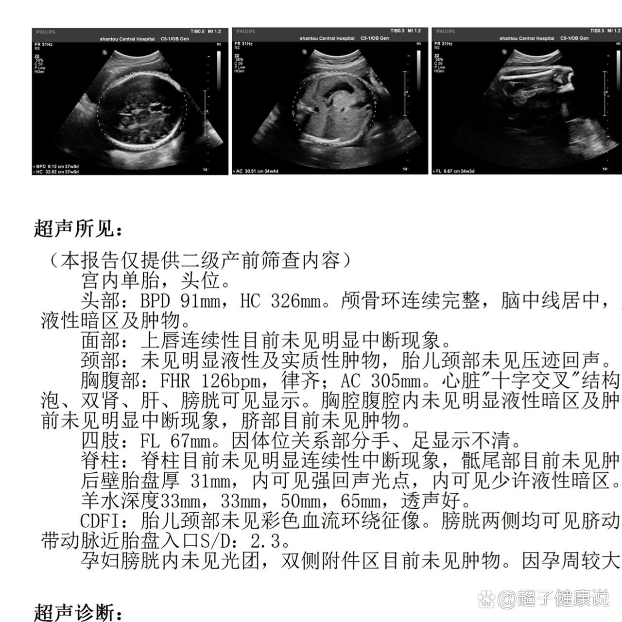 双顶径的测量示意图图片