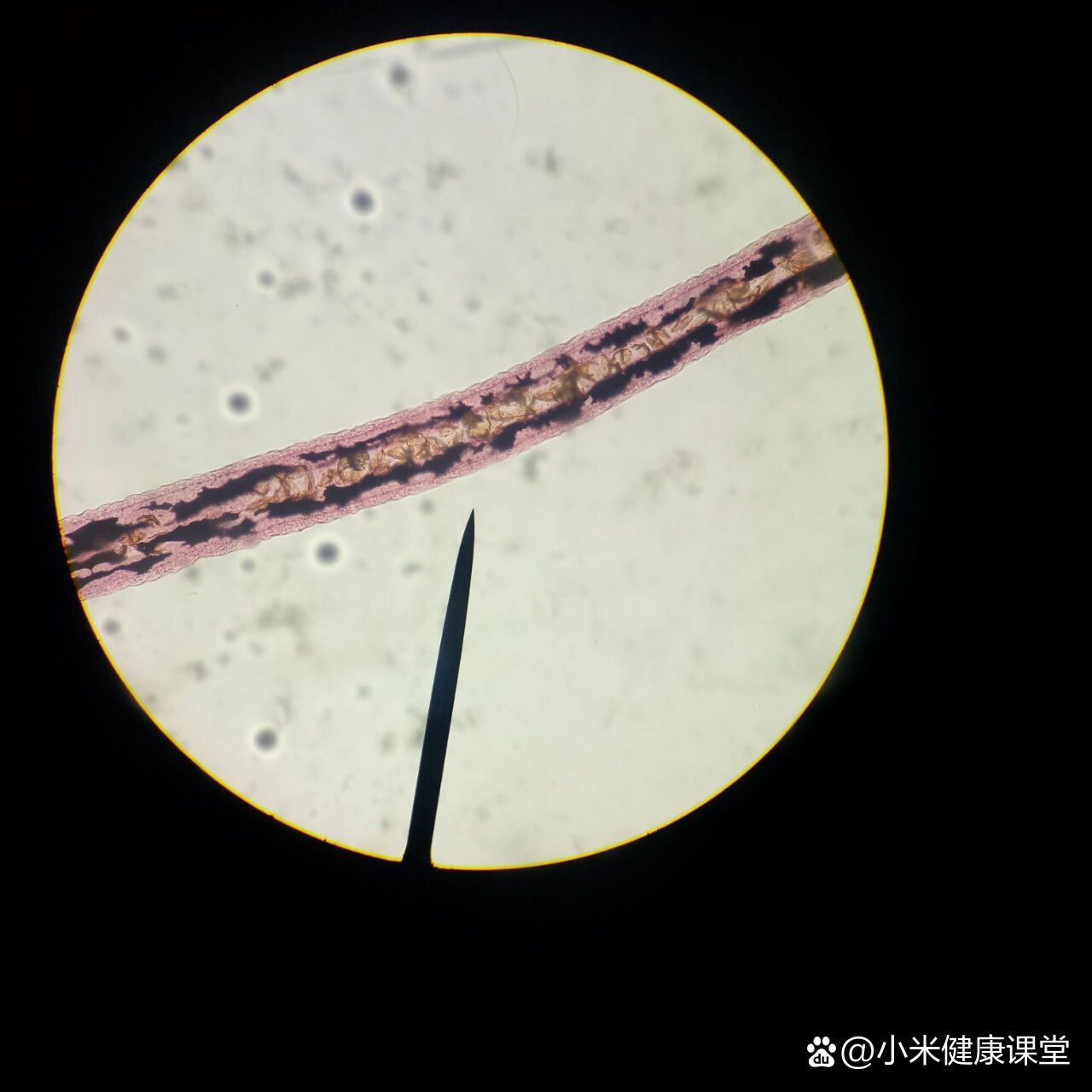  p>一天认识一条虫——日本血吸虫(female) br>   低倍镜下观察雌虫口