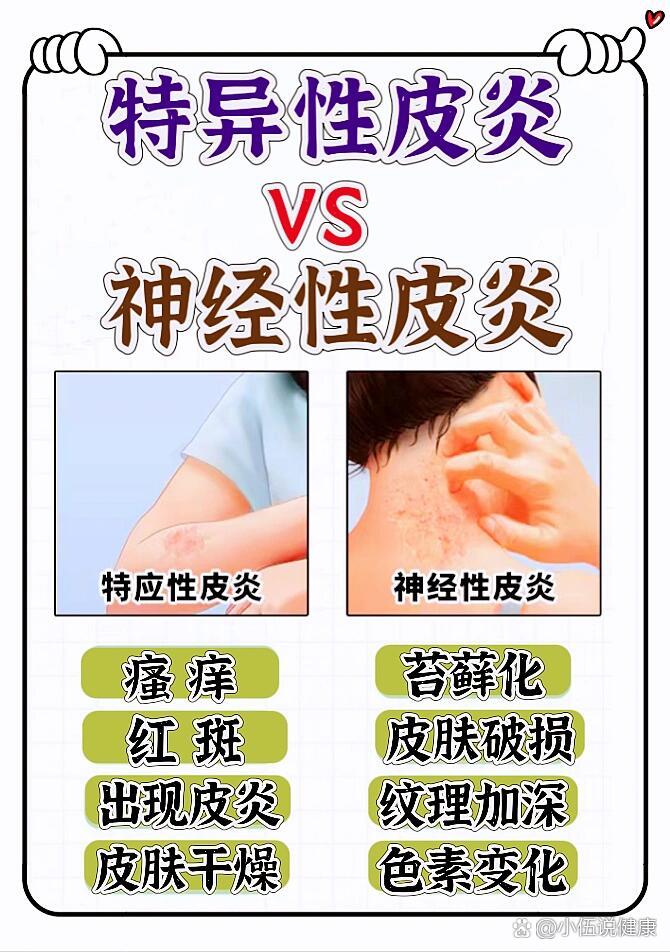 15能帮一个是一个 br>97很多人不会区分特异性皮炎和脂溢性皮炎