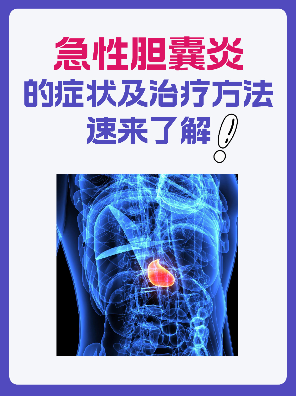 急性胆囊炎的症状及治疗方法,速来了解!
