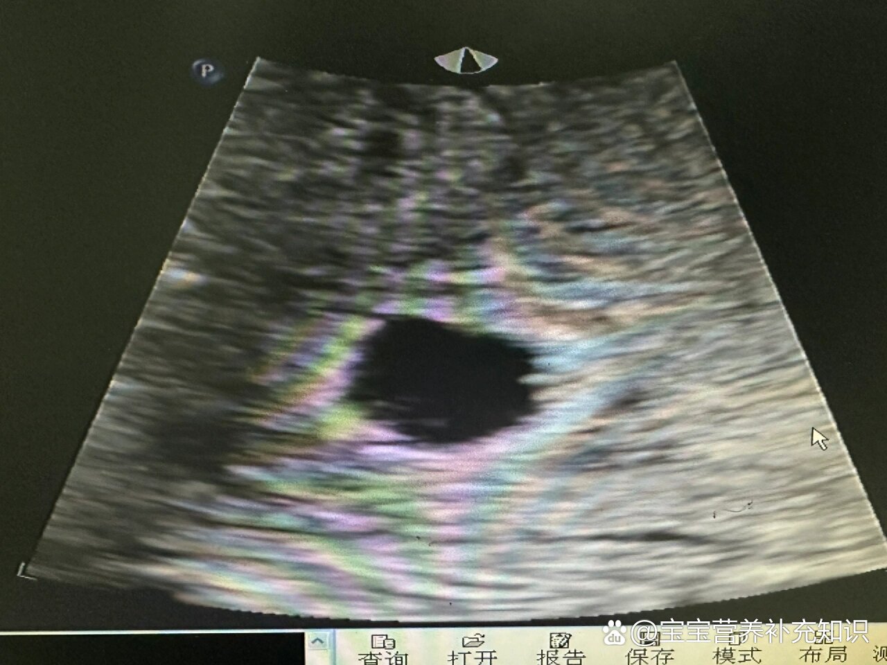 只有孕囊要超度-怎么确认孕囊掉完整了