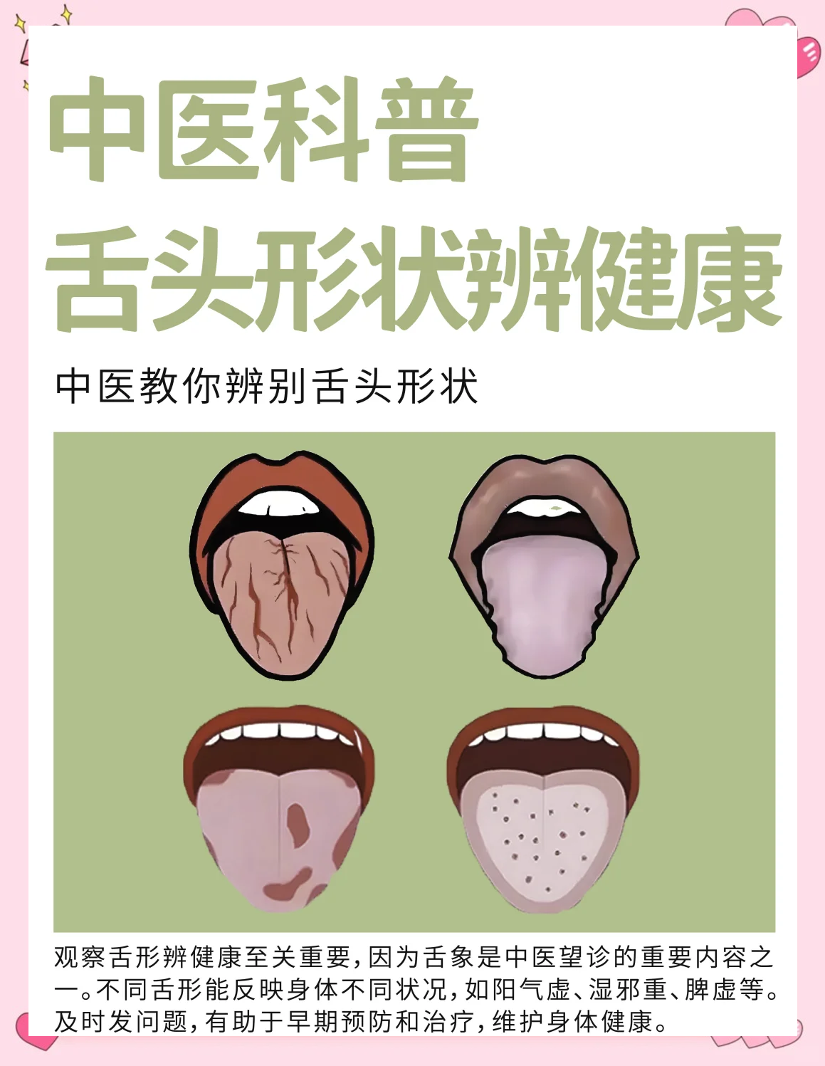 中医舌诊：舌头形状透露的健康秘密