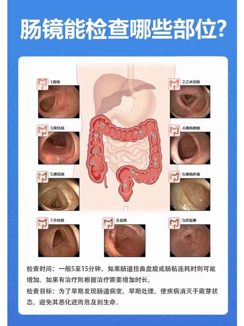 肠镜6张图片对应部位图片