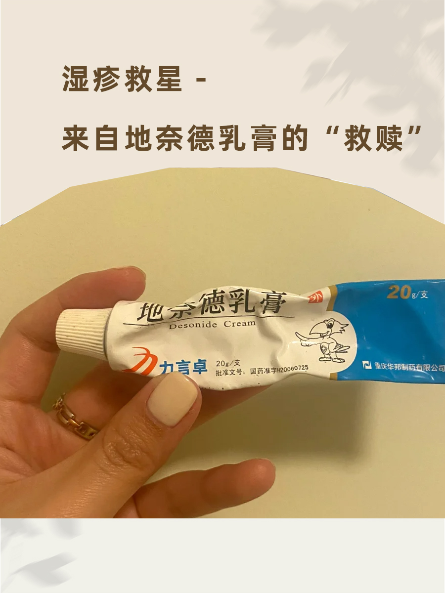 湿疹救星-来自地奈德乳膏的"救赎"