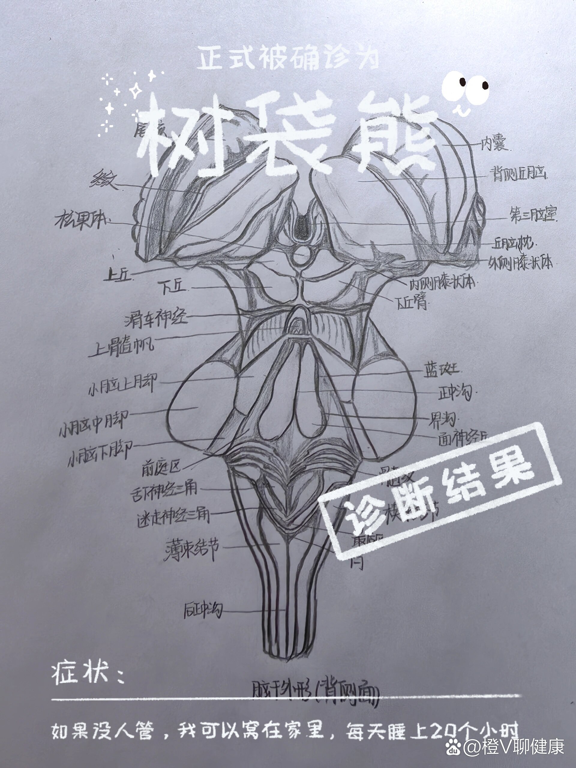 大脑半球外侧面素描图片