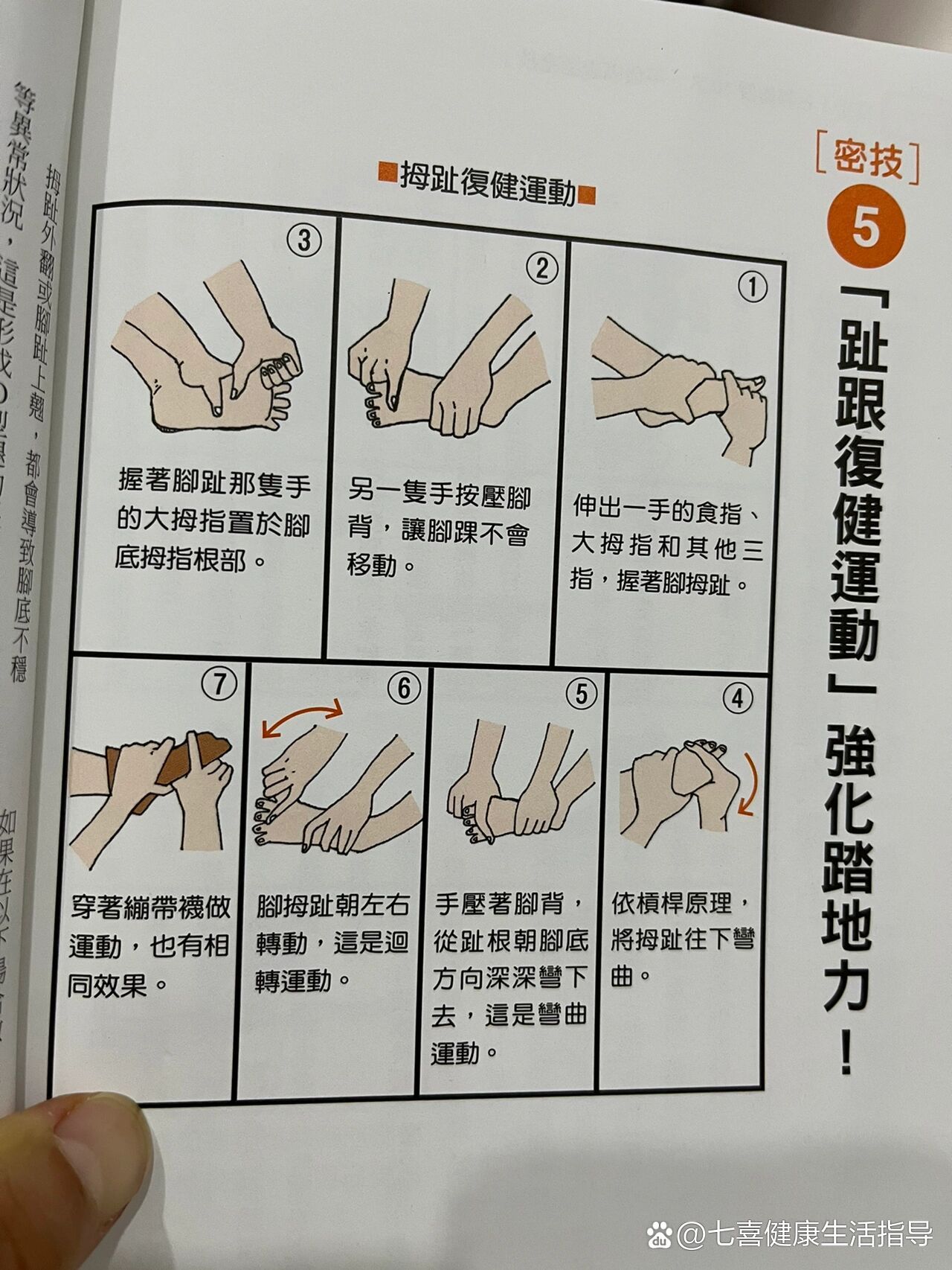 接上上篇拇指外翻怎么矫正
