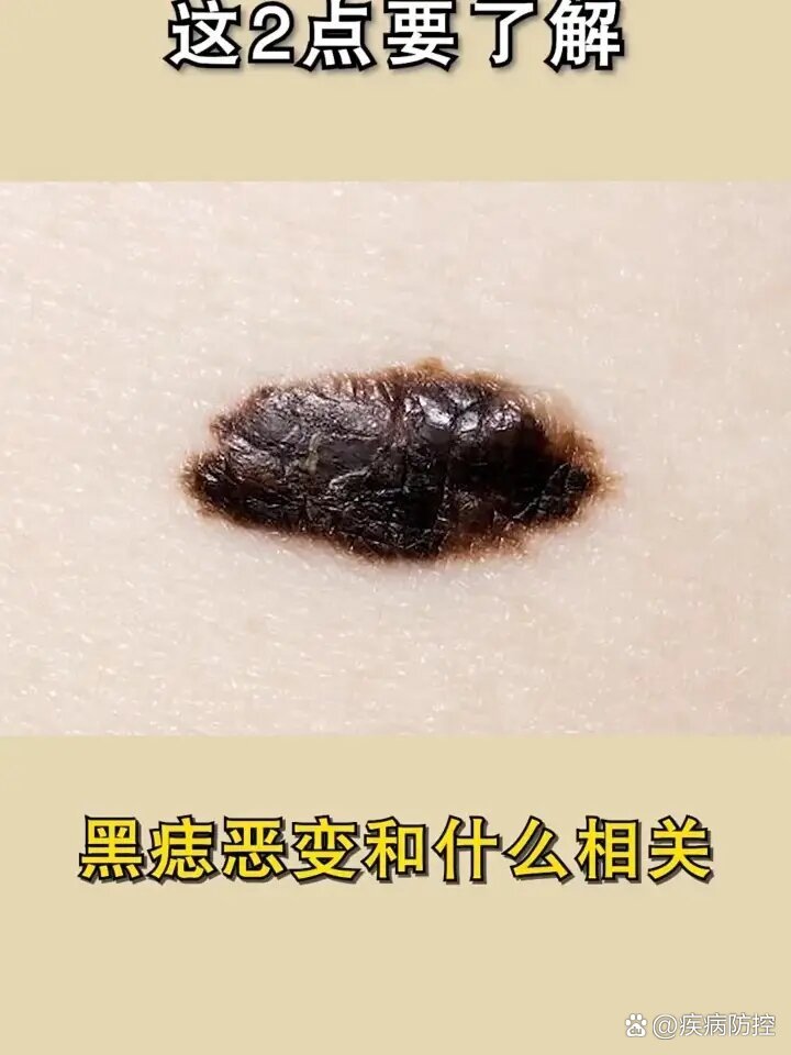 根据生长皮肤深度的不同