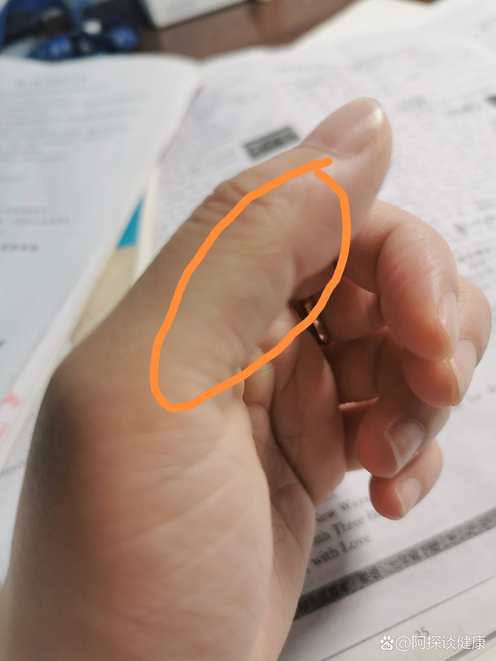 右手大拇指发麻 全网资源