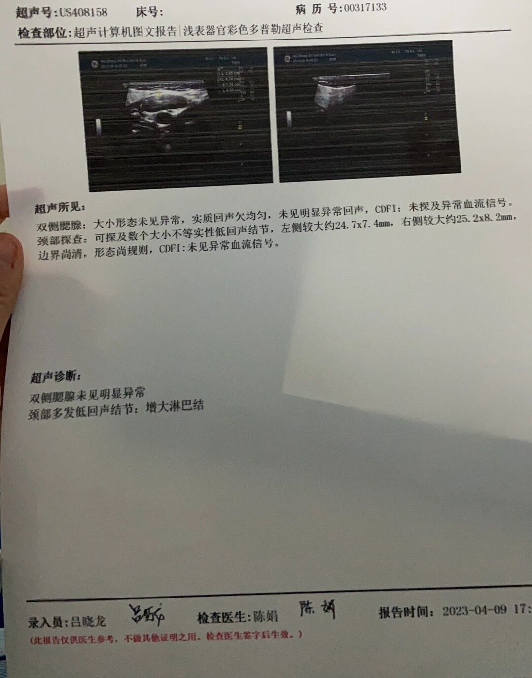 3岁小孩颈部淋巴结肿大有经验的帮忙看看可