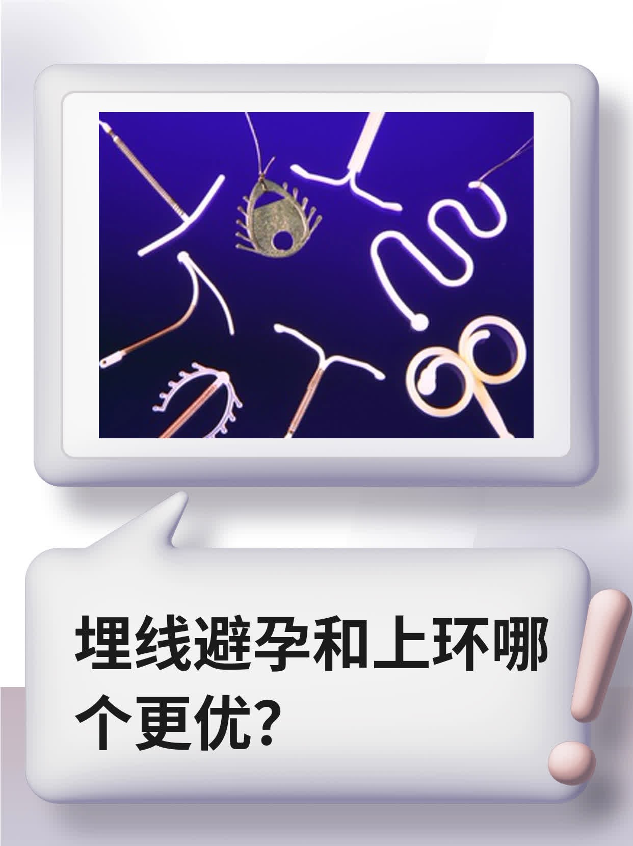 埋线避孕和上环哪个更优