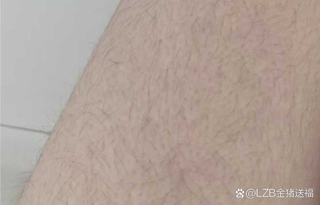 女生体毛旺盛是什么样的体验？