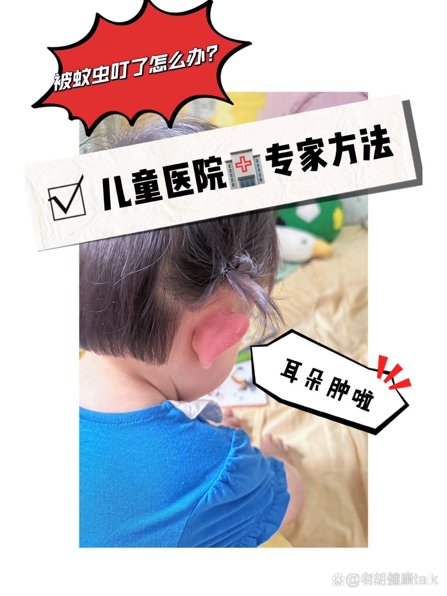 宝宝耳朵肿了