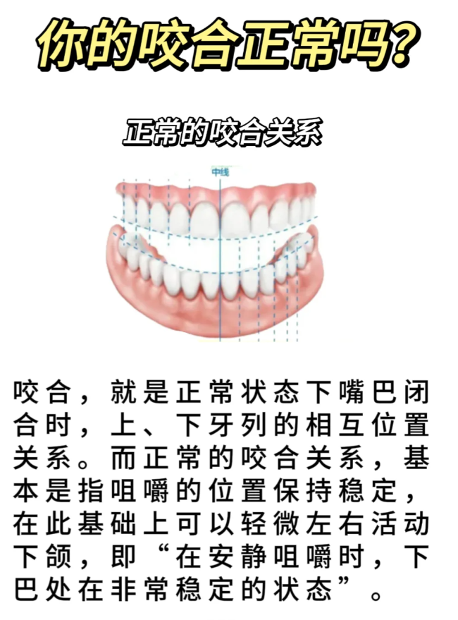 你的牙齿咬合正常吗?