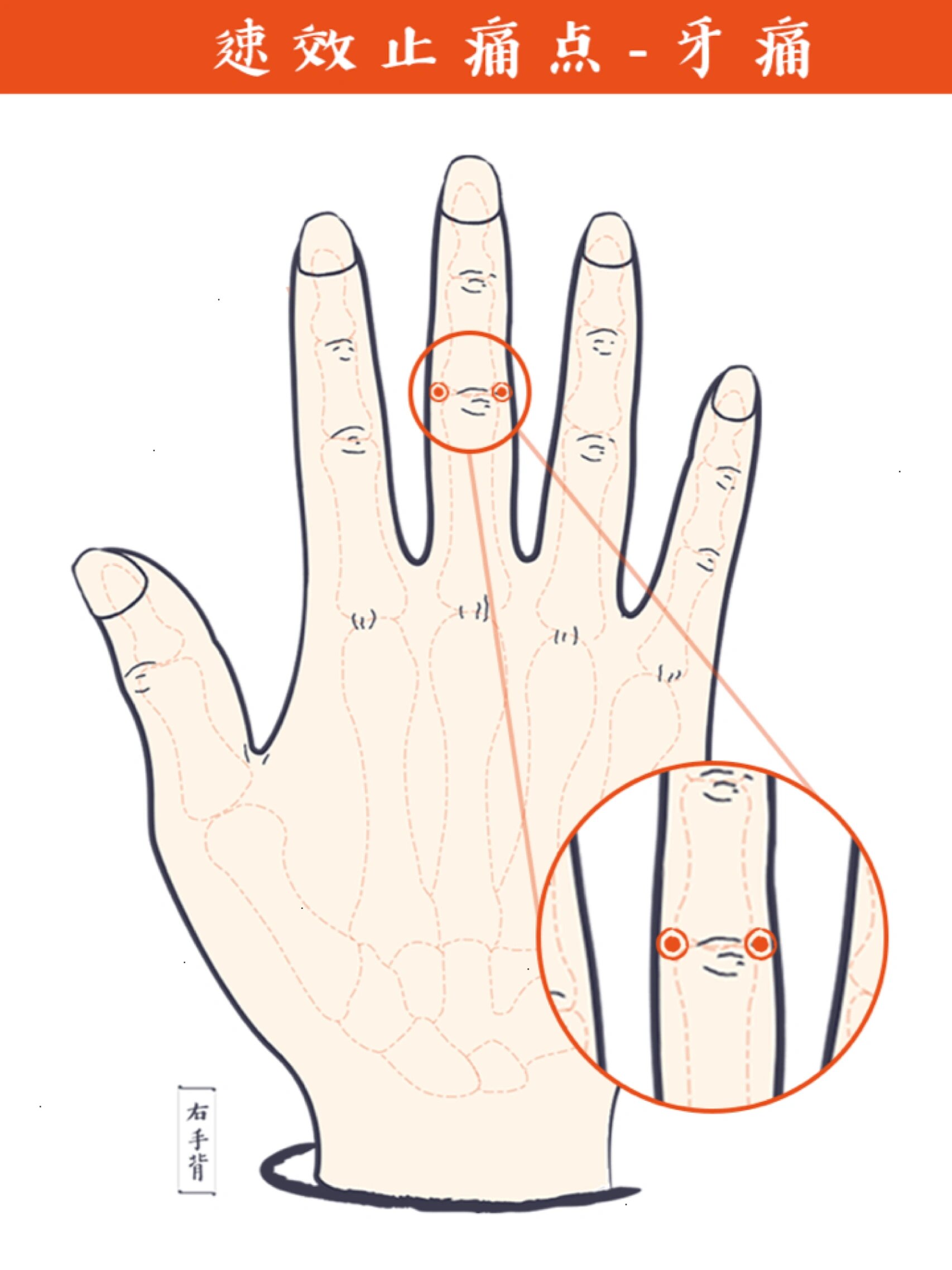 手上有个牙痛穴