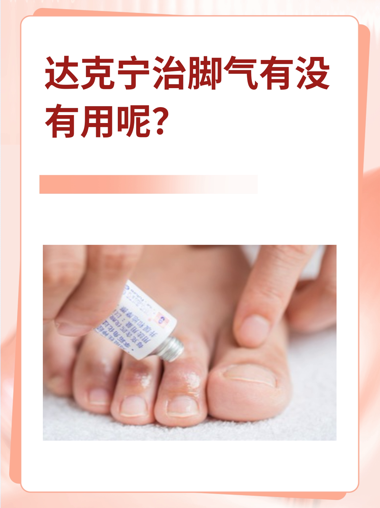 达克宁治脚气广告图片