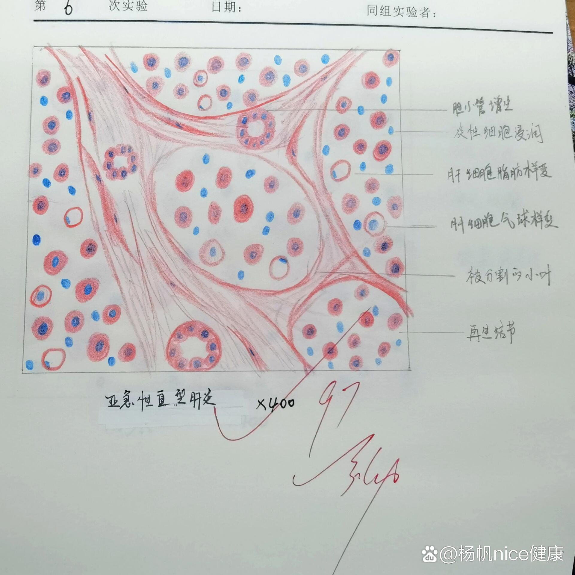 病理切片红蓝绘图分享②
