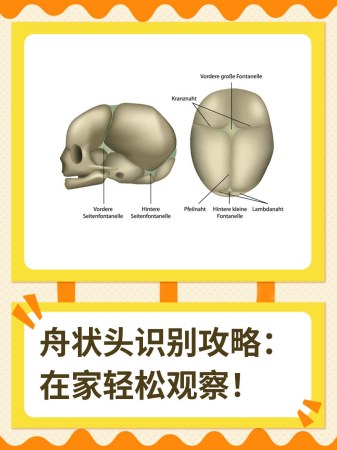 舟状头识别攻略：在家轻松观察
