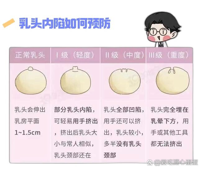 乳头正常女性深度图片