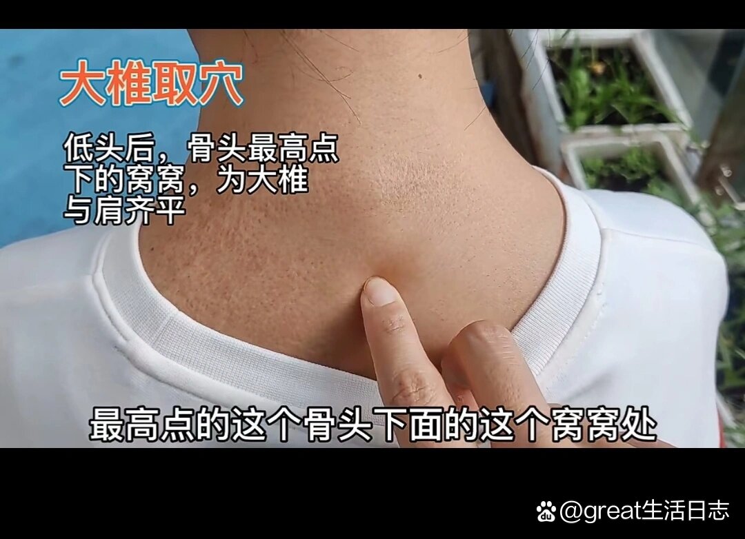 关于感冒,咳嗽,发烧抗炎第一的大椎穴