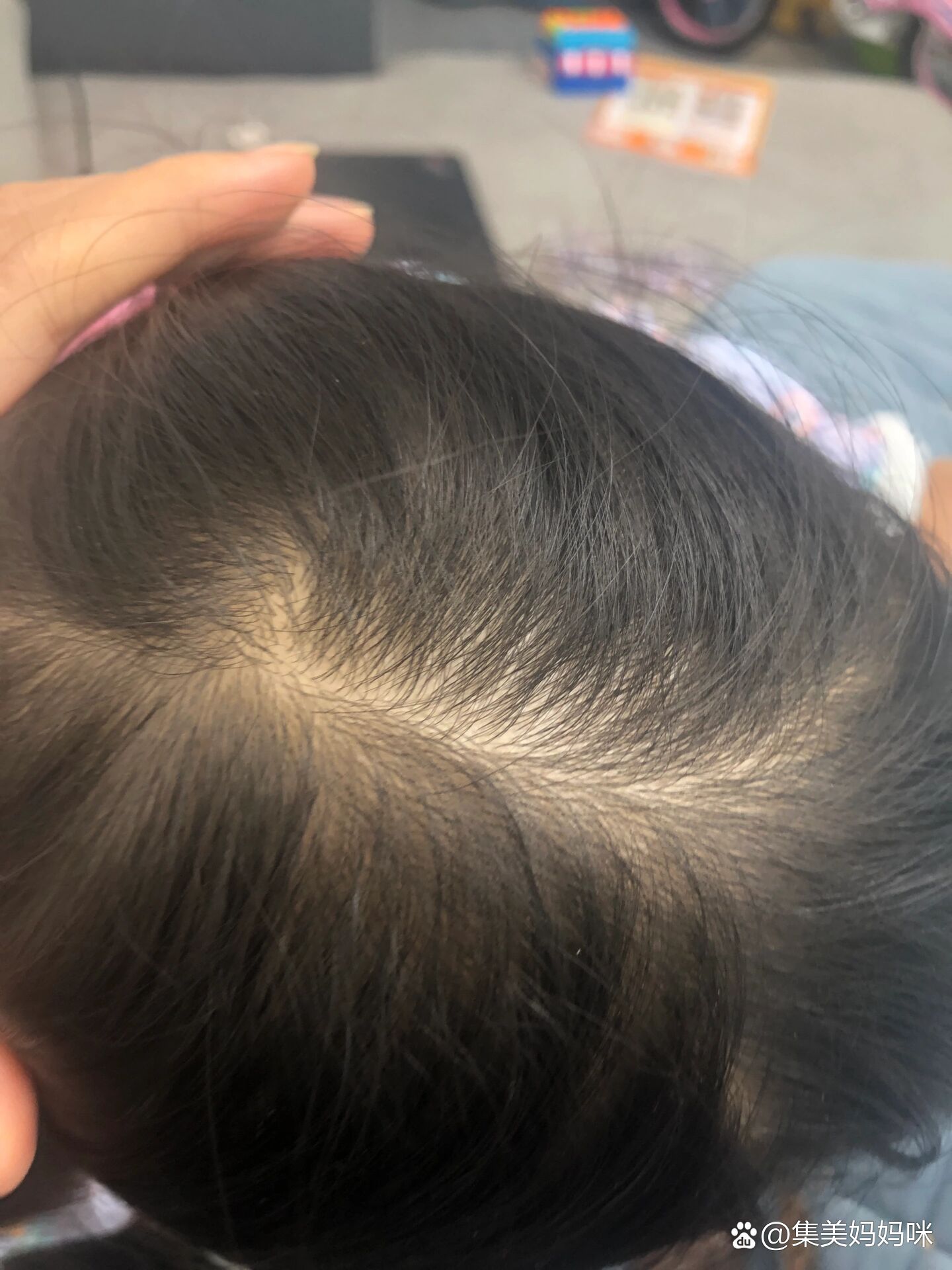 小孩子头发很少怎么才能长头发