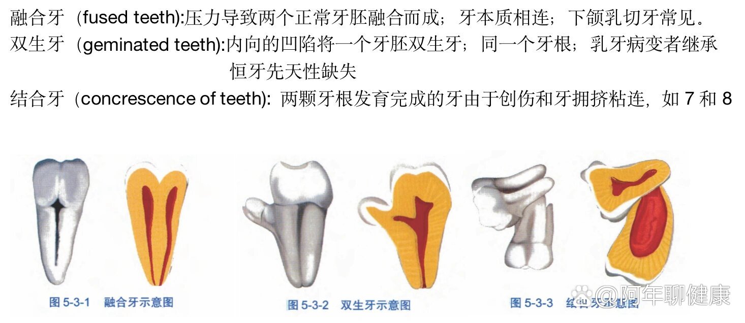 牙体牙髓之融合牙结合牙双生牙鉴别
