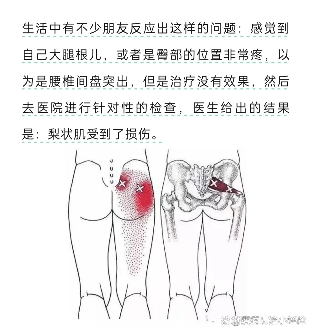 腿根在哪个位置图图片