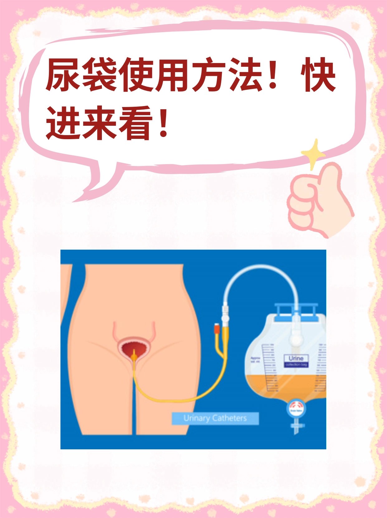 尿袋使用方法!快进来看