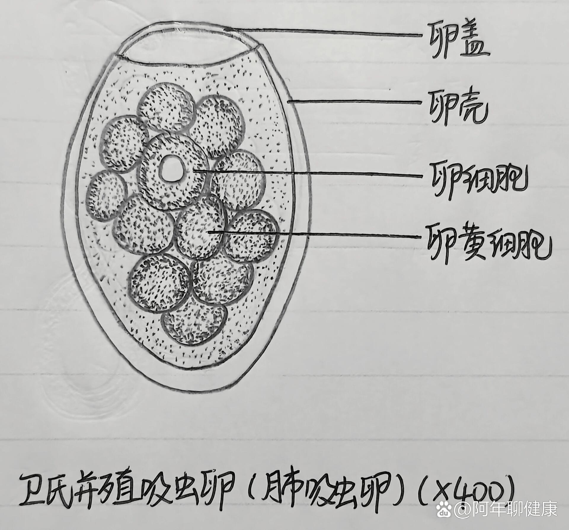 高清肝包虫图片 虫卵图片