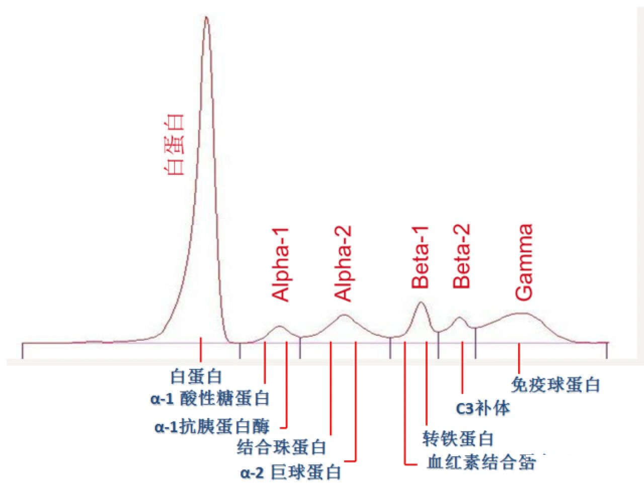 血清蛋白五条区带的图图片