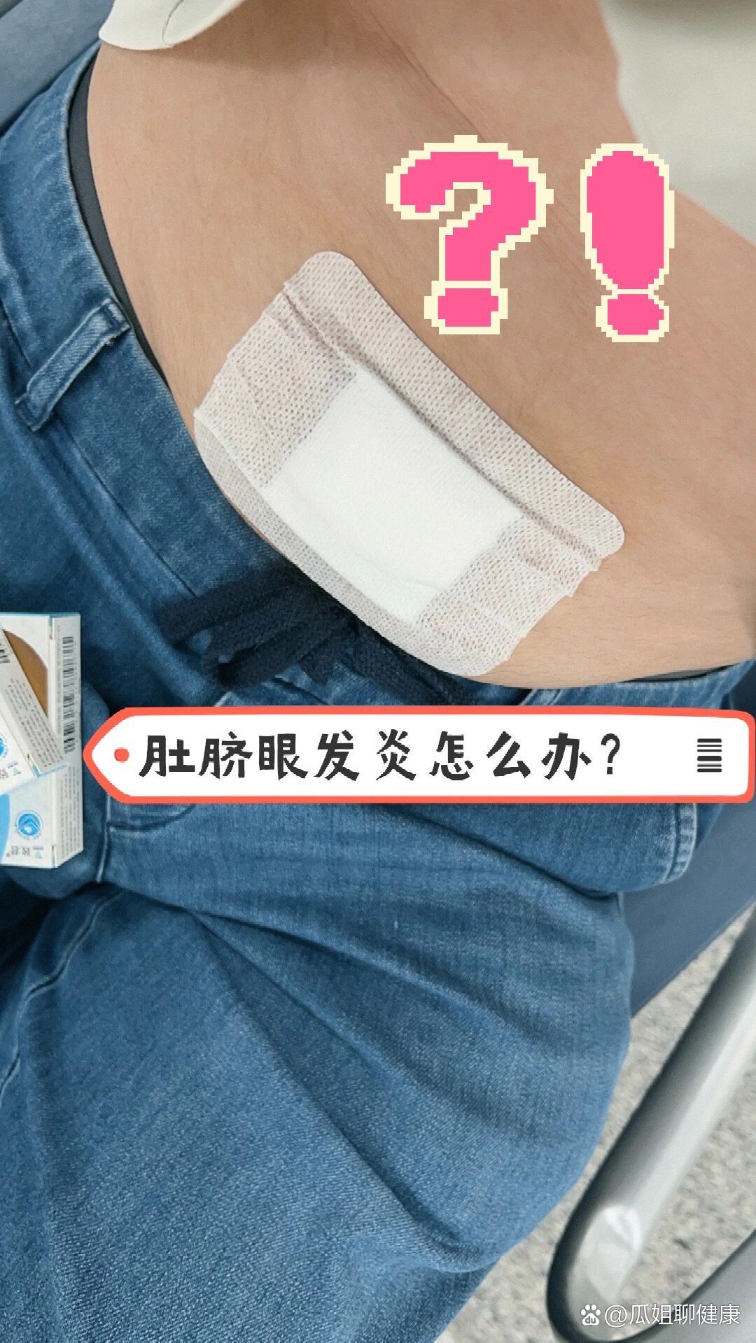 肚脐儿痒抠了,发炎了,怎么办?