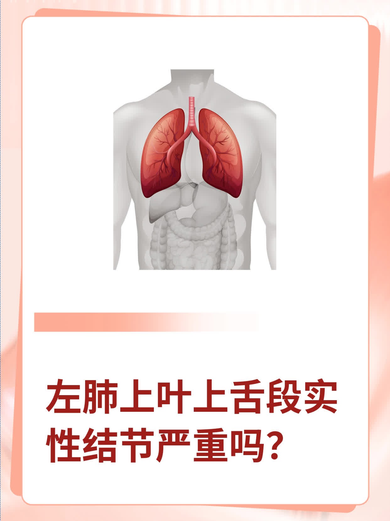 左肺上叶上舌段实性结节严重吗