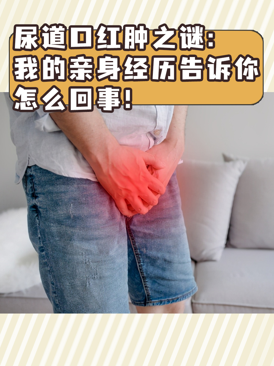 尿道口红肿之谜:我的亲身经历告诉你怎么回事!