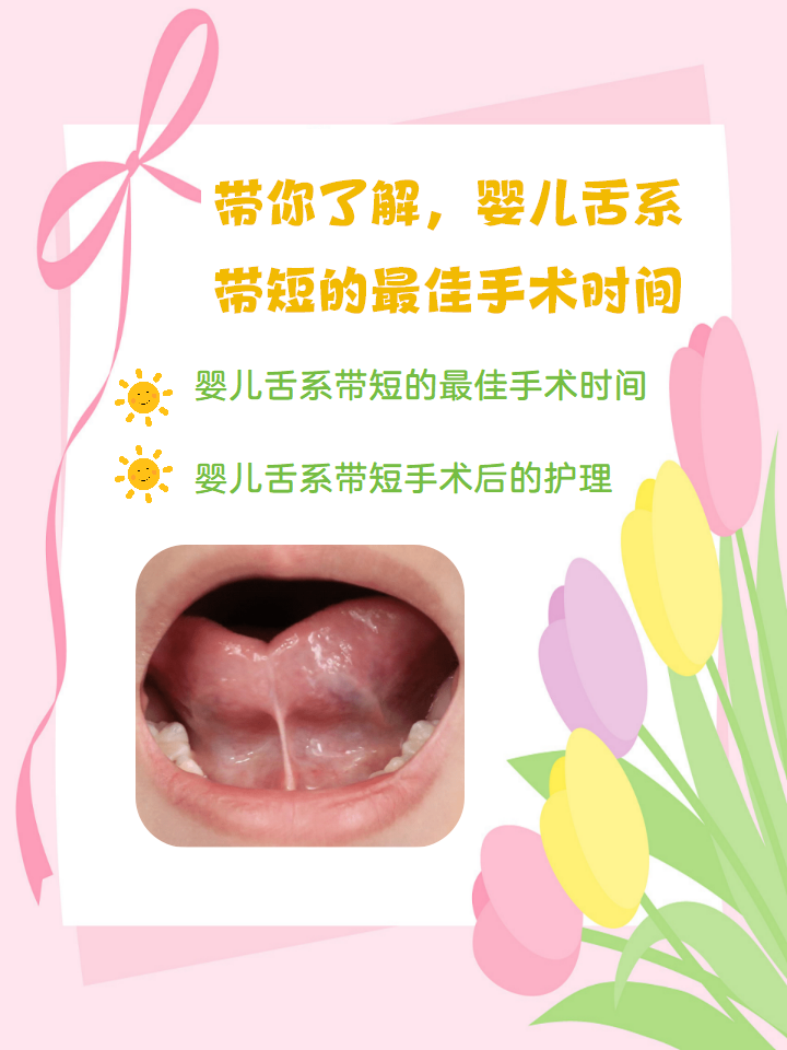 带你了解,婴儿舌系带短的最佳手术时间