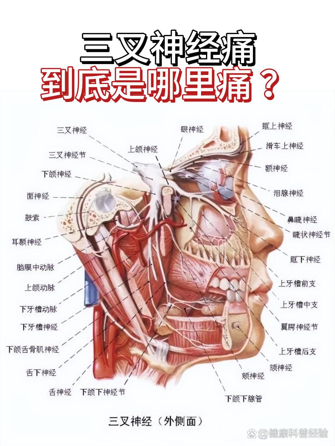 三叉神经位置图片