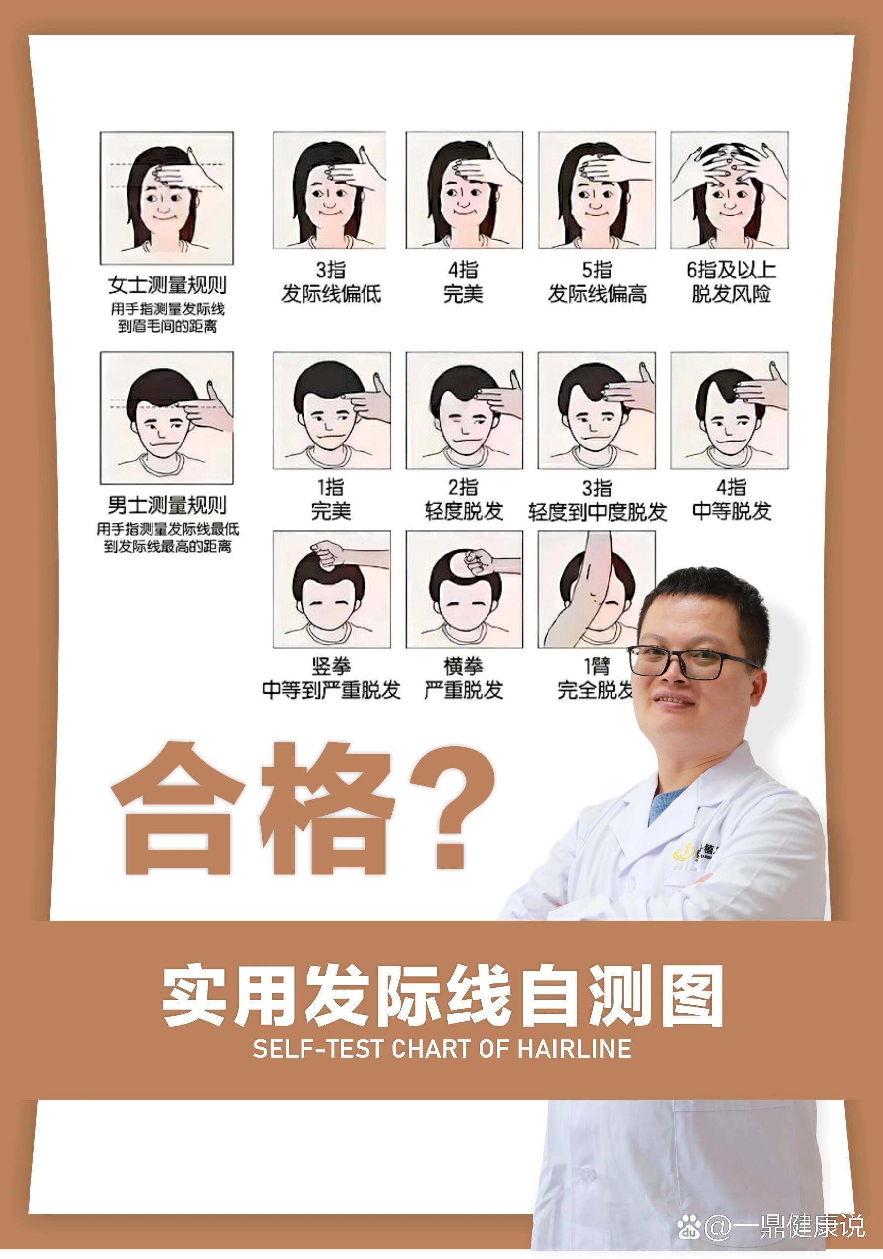 女性发际线类型图解图片