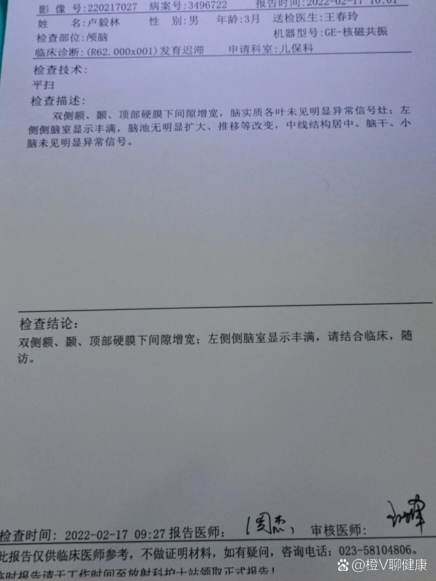 26周早产儿脑部核磁共振