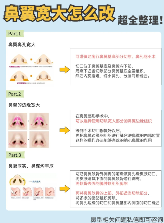 鼻翼沟成形手术图解图片